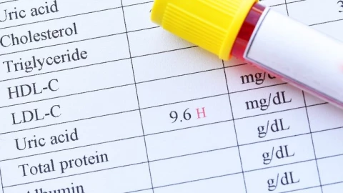 Giải mã 3 chỉ số xét nghiệm máu: Cao hơn có phải luôn tốt hơn?