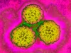 Nghiên cứu mới: 1/8 ca ung thư toàn cầu liên quan đến khuẩn HP và virus HPV, có thể phòng ngừa được