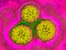 Nghiên cứu mới: 1/8 ca ung thư toàn cầu liên quan đến khuẩn HP và virus HPV, có thể phòng ngừa được
