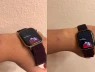 Người dùng Apple Watch Series 12 và Ultra 4 phản ánh tình trạng kích ứng da