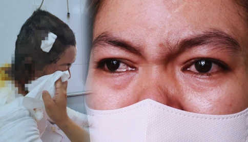 Chua xót người mẹ bị con tẩm xăng đốt cho biết không giận con trai ra sức bênh vực con