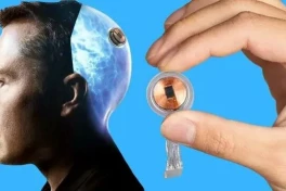 Công ty Neuralink của Elon Musk thực hiện thành công việc cấy chip vào não người cho bệnh nhân thứ 2 trên thế giới