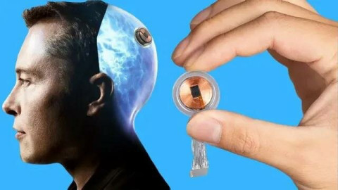 Công ty Neuralink của Elon Musk thực hiện thành công việc cấy chip vào não người cho bệnh nhân thứ 2 trên thế giới