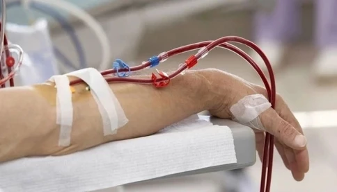 Lọc máu loại bỏ mỡ máu được không? Bộ Y tế vào cuộc