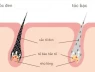 Tóc bạc trắng, liệu có thể đen lại được không? Giải đáp chi tiết đây!
