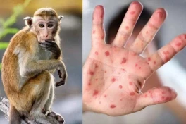 Quá khẩn cấp! WHO phải ban bố tình trạng khẩn cấp toàn cầu lần thứ 2 vì 1 căn bệnh này