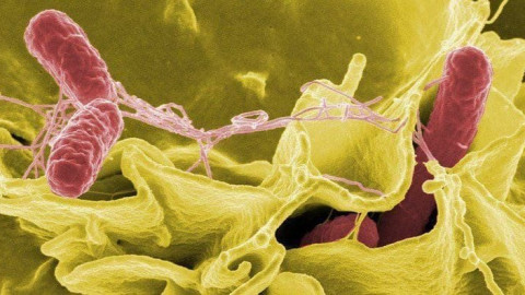 Khuẩn Salmonella là gì mà khiến 149 người ở Đồng Tháp bị nhập viện?