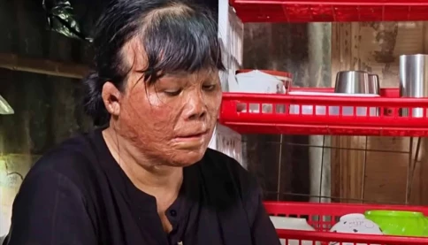 Người phụ nữ cứu đứa trẻ bị bỏng 78% sau 4 lần định quyên sinh và cái kết sau 18 năm