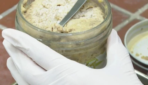 Thanh niên 25 tuổi liệt tứ chi, nguy kịch sau khi ăn pate bảo quản kém