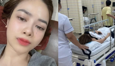 Nhờ ca sĩ Mỹ Linh hỏi, Dương Hoàng Yến mới phát hiện bị lệch mặt, liệt dây thần kinh số 7 phải cấp cứu nửa đêm
