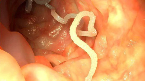 Ẩn họa khôn lường từ bát tiết canh sống, món ăn khoái khẩu của nhiều người Việt