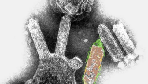 Tử vong vì nhận thận của người bị mắc bệnh dại