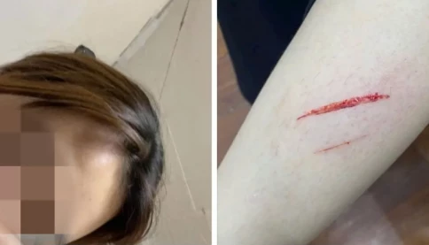 Xôn xao vụ nữ sinh bị đánh nhập viện vì mâu thuẫn “tiền tip”: Chủ nhà hàng ở Hà Nội nói gì?