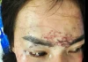 Khởi tố vụ án đánh ghen tàn nhẫn, xăm lên mặt, tạt axit xôn xao dư luận