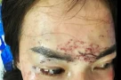 Khởi tố vụ án đánh ghen tàn nhẫn, xăm lên mặt, tạt axit xôn xao dư luận