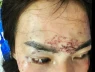 Khởi tố vụ án đánh ghen tàn nhẫn, xăm lên mặt, tạt axit xôn xao dư luận