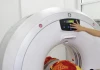 Ung thư thận âm thầm: Ca bệnh điển hình không có triệu chứng thường gặp