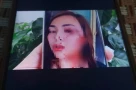 Khởi tố vụ người phụ nữ ở Nha Trang bị rạch mặt