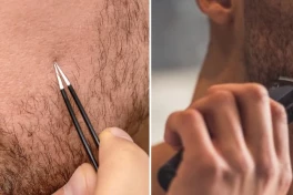 Nên nhổ râu hay nên cạo râu? So sánh nhổ râu và cạo râu