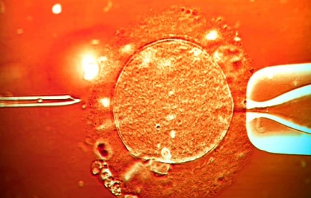 Trớ trêu: Người hiến tinh trùng mang gene ung thư khiến 10 trẻ mắc bệnh