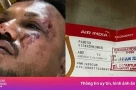 Thật khó tin: Diễn viên Thái và nạn nhân vụ Air India đều thoát chết ở ghế 11A