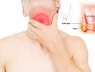 Ai có nguy cơ mắc ung thư tuyến giáp?