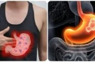 5 triệu chứng buổi sáng cảnh báo ung thư dạ dày