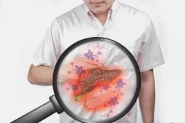 Ba "đen" trên cơ thể cảnh báo gan đang kêu cứu