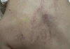 Điều tra vụ bố bé gái 4 tuổi tố con bị cô giáo đánh, kéo lê, ném vào tường, có bằng chứng camera ghi