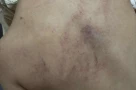 Điều tra vụ bố bé gái 4 tuổi tố con bị cô giáo đánh, kéo lê, ném vào tường, có bằng chứng camera ghi