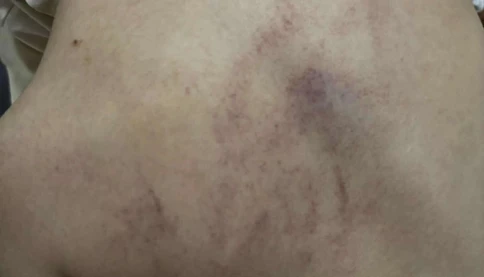 Điều tra vụ bố bé gái 4 tuổi tố con bị cô giáo đánh, kéo lê, ném vào tường, có bằng chứng camera ghi