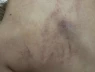 Điều tra vụ bố bé gái 4 tuổi tố con bị cô giáo đánh, kéo lê, ném vào tường, có bằng chứng camera ghi