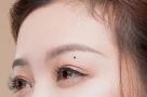 3 nốt ruồi phá tài: Trẻ thì lận đận công danh, già thì hao tài nghèo khổ