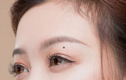 3 nốt ruồi phá tài: Trẻ thì lận đận công danh, già thì hao tài nghèo khổ