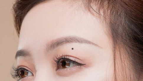 3 nốt ruồi phá tài: Trẻ thì lận đận công danh, già thì hao tài nghèo khổ