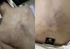 Không chấp nhận được lời thú nhận của cô giáo mầm non đánh, kéo lê và ném bé gái 4 tuổi vào tường