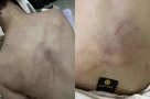 Không chấp nhận được lời thú nhận của cô giáo mầm non đánh, kéo lê và ném bé gái 4 tuổi vào tường