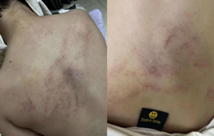Không chấp nhận được lời thú nhận của cô giáo mầm non đánh, kéo lê và ném bé gái 4 tuổi vào tường