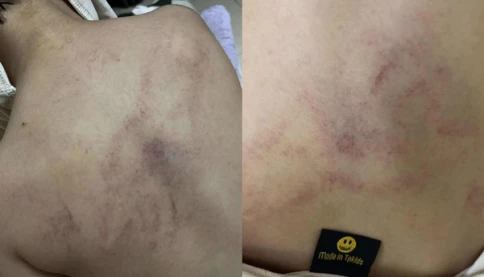 Không chấp nhận được lời thú nhận của cô giáo mầm non đánh, kéo lê và ném bé gái 4 tuổi vào tường