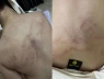 Không chấp nhận được lời thú nhận của cô giáo mầm non đánh, kéo lê và ném bé gái 4 tuổi vào tường