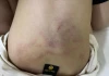 Vụ bé gái bị đánh, kéo lê tại trường mầm non: Tạm đình chỉ giáo viên chứng kiến nhưng không quan tâm