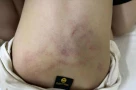Vụ bé gái bị đánh, kéo lê tại trường mầm non: Tạm đình chỉ giáo viên chứng kiến nhưng không quan tâm
