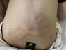 Vụ bé gái bị đánh, kéo lê tại trường mầm non: Tạm đình chỉ giáo viên chứng kiến nhưng không quan tâm