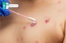 Người đàn ông đi cấp cứu với dấu hiệu lạ ở v.ùng kín