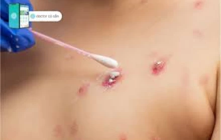 Người đàn ông đi cấp cứu với dấu hiệu lạ ở v.ùng kín
