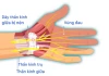 "Bàn tay chuột" là gì và nó phổ biến cỡ nào mà Trung Quốc phải đưa vào danh sách bệnh nghề nghiệp