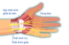 "Bàn tay chuột" là gì và nó phổ biến cỡ nào mà Trung Quốc phải đưa vào danh sách bệnh nghề nghiệp