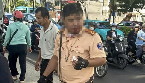 Trung tá CSGT bị người nước ngoài đấm vào mặt khi đang làm nhiệm vụ