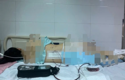 Khởi tố vụ cô gái mất 96% sức khỏe vì bị khung đỡ đèn tiệc cưới đổ sập, đè lên người