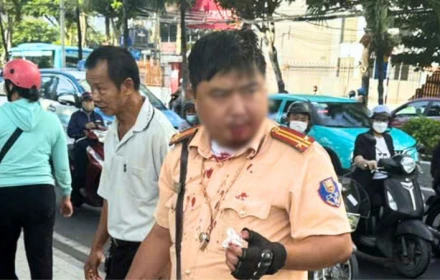 Du khách người Nga đấm CSGT Nha Trang thương tích có nồng độ cồn kịch khung
